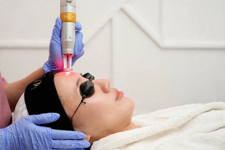 Birthday Complimentary - MelaKlear Laser 785